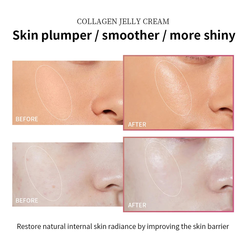 100ml Collagen Jelly Cream Niacinamide Tightening Soothing Moisturizing Anti-Aging Firmness Hydration Skincare 100ml Face Gel